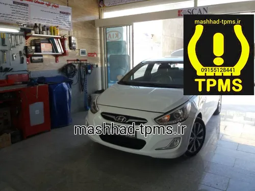 سنسور باد لاستیک هیوندا النترا
